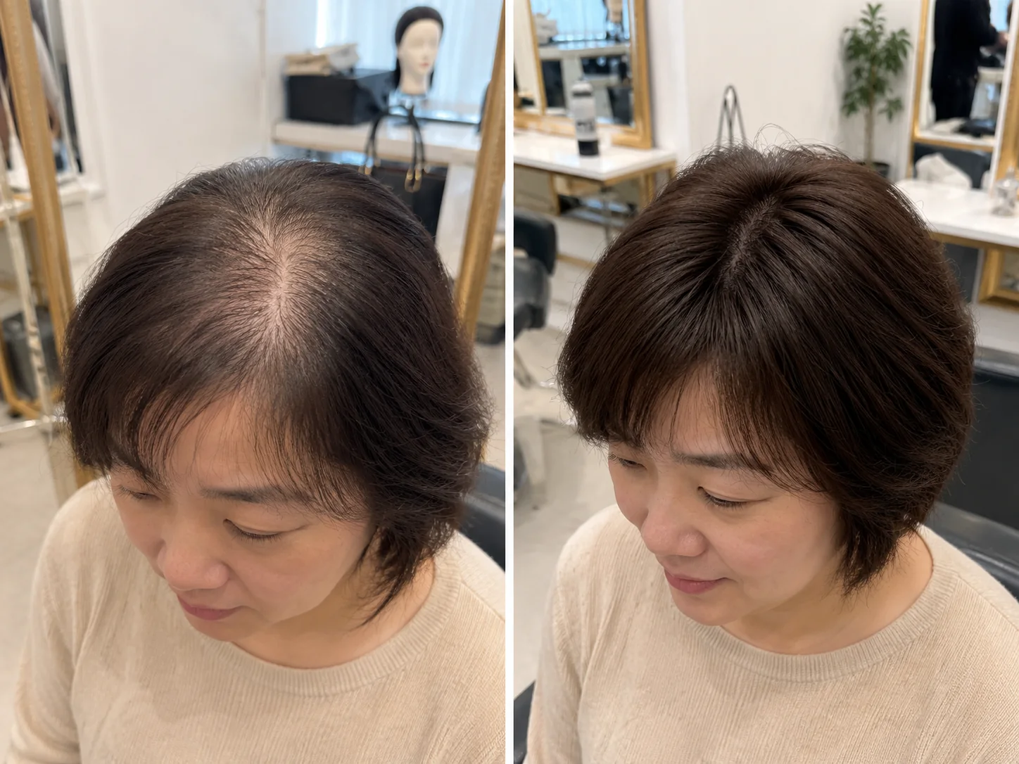 头顶稀疏顾客补发前后对比参考,重点观察顶部覆盖和发缝自然度